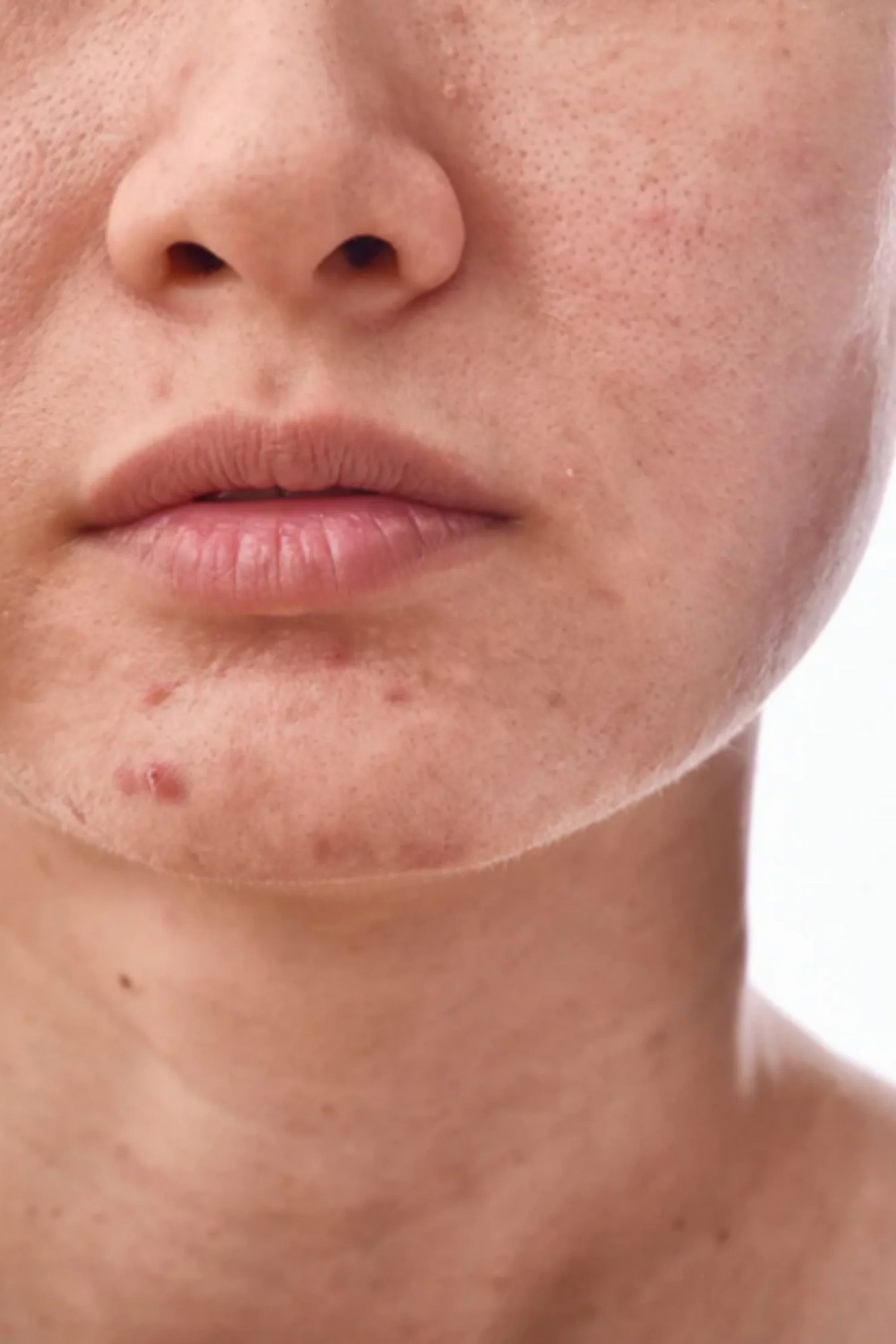 Allattamento & pelle spenta: i 3 errori più comuni